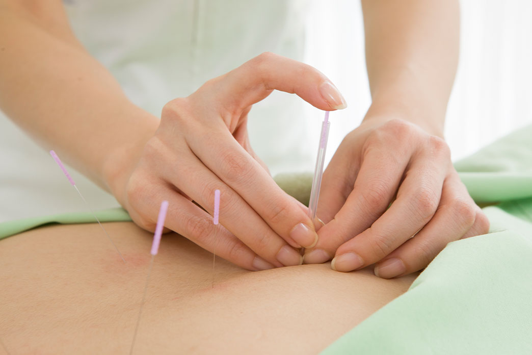 Person performing acupuncture