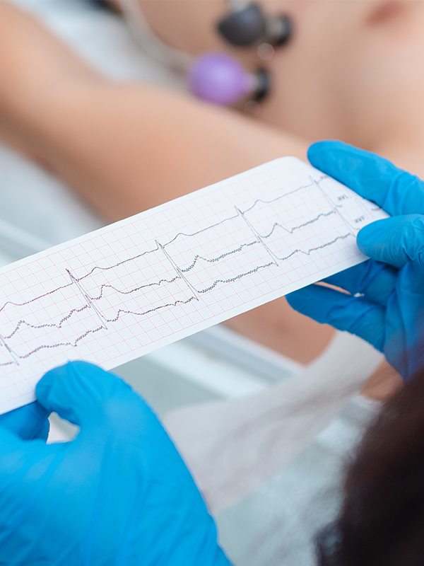 Heart cardiogram in the hands of a doctor close-up