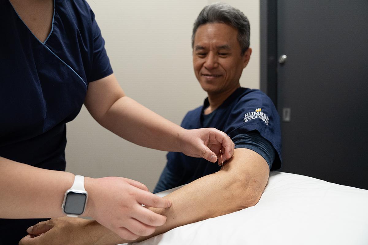 A person places a small acupuncture needle into another person’s arm.